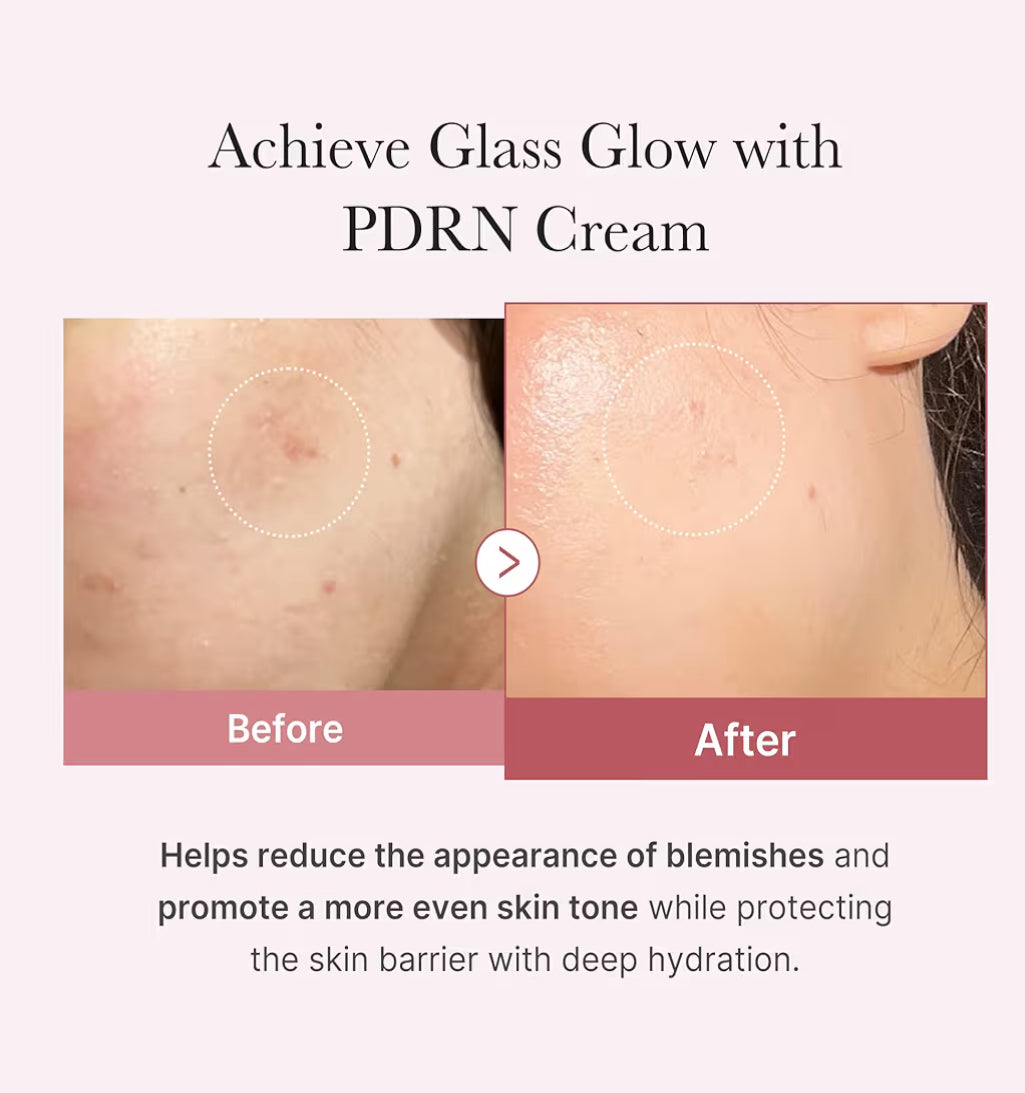 Medicube Salmon DNA PDRN Pink Hyaluronic Moisturizing Cream – 50 ml