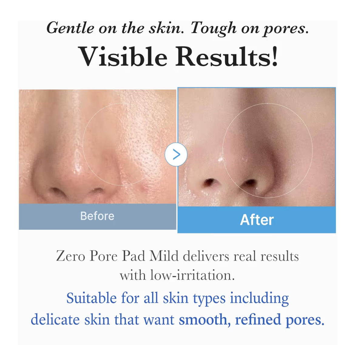 Medicube Zero Pore Toner Pads Mild Gentle – 70 Pads